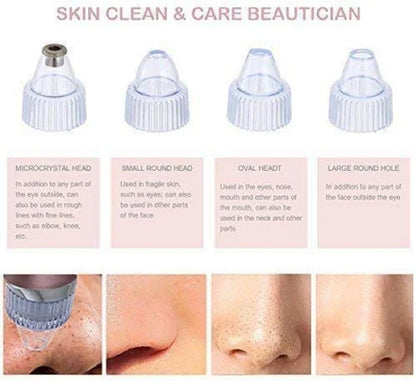 جهاز تنظيف البشرة وإزالة الشوائب من المسام | Pore Cleaner & Facial Skin Care Device