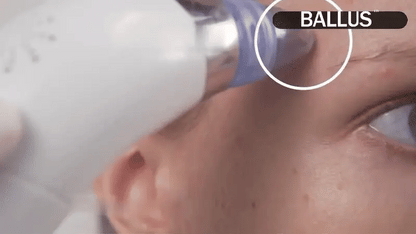 جهاز تنظيف البشرة وإزالة الشوائب من المسام | Pore Cleaner & Facial Skin Care Device